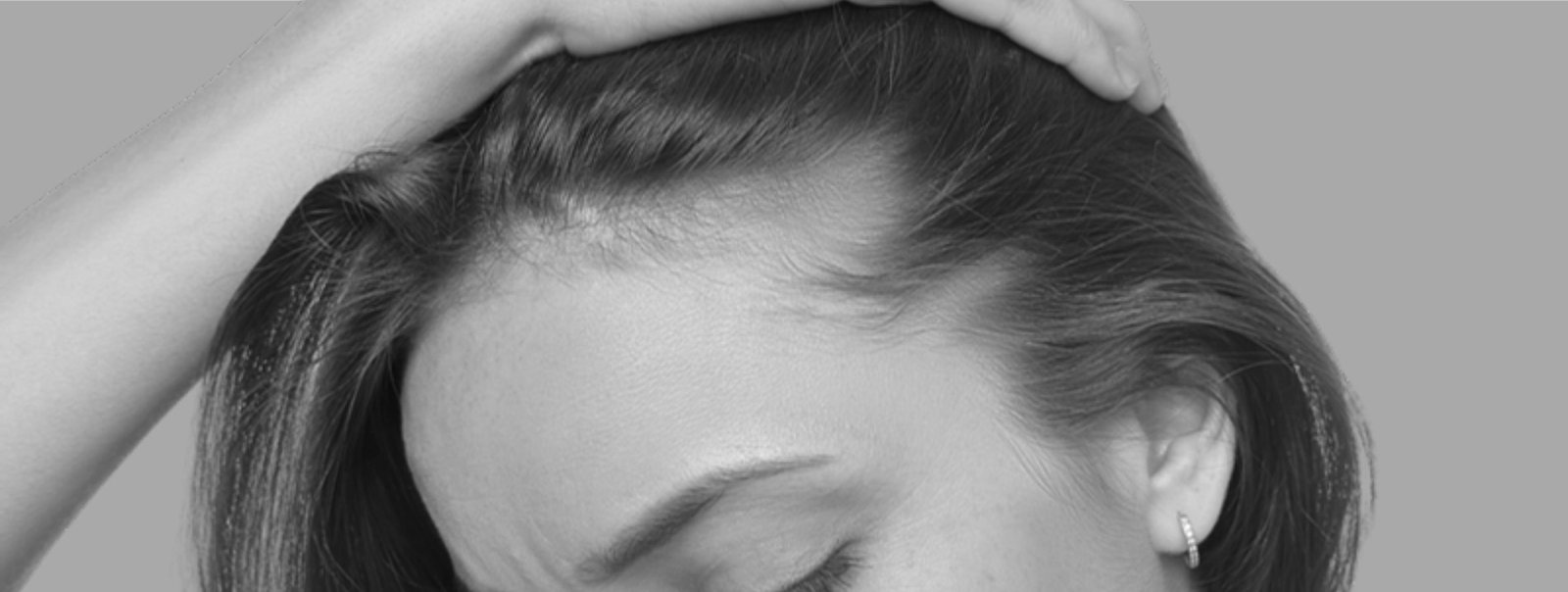 Scalp Restore — Nanopigmentación capilar